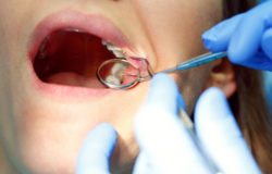 Routine dental checkups in Arlington Heights IL