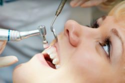 Dental cleanings in Arlington Heights  IL