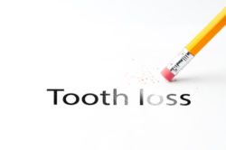 treating tooth loss at AH Smiles in Arlington Heights IL