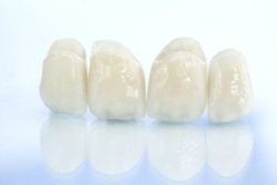 Dental crowns at AH Smiles in Arlington Heights IL