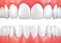 Treating Periodontitis in Arlington Heights IL