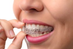 Invisalign for crooked teeth in Arlington Heights IL