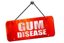 treating gum disease in Arlington Heights IL at AH Smiles