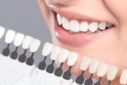 Is teeth whitening right for you Arlington heights il