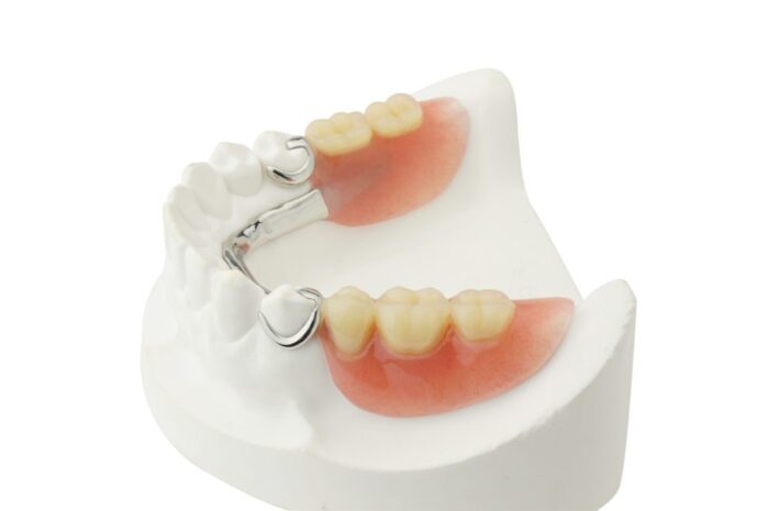 Dentures for missing teeth in Arlington Heights IL