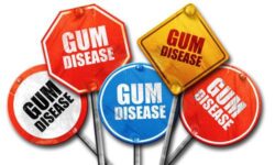 periodontal therapy to treat gum disease