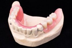 Dentures and partials in Arlington Heights IL