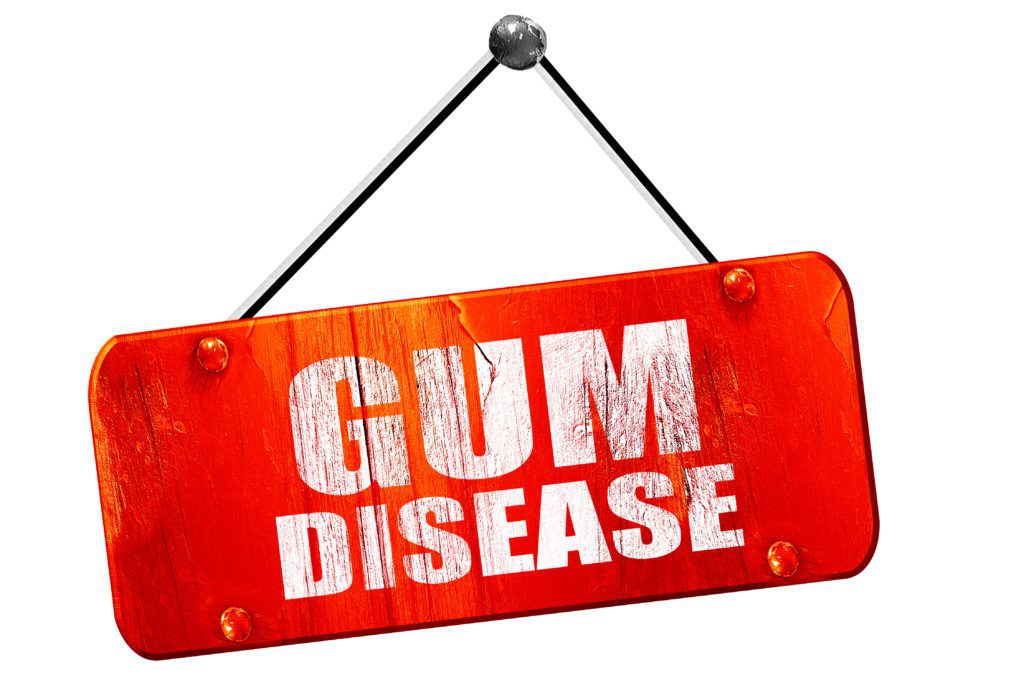 Why Do My Gums Hurt? Arlington Heights IL Dentist