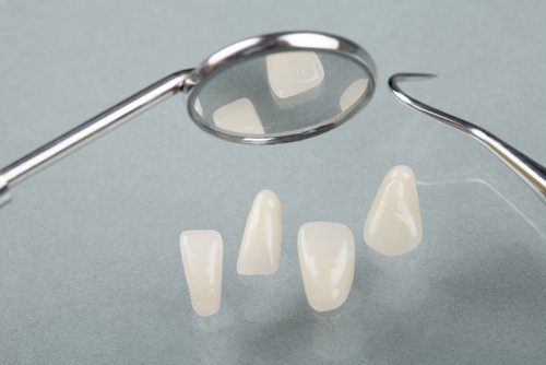 porcelain veneers in Arlington Heights, Illinois