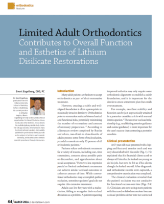 Limited Adult Orthodontics Contributes to Overall Function and Esthetics of Lithium Disilicate Restorations
