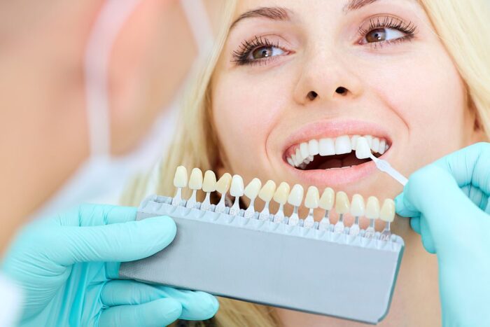 teeth whitening arlington heights il