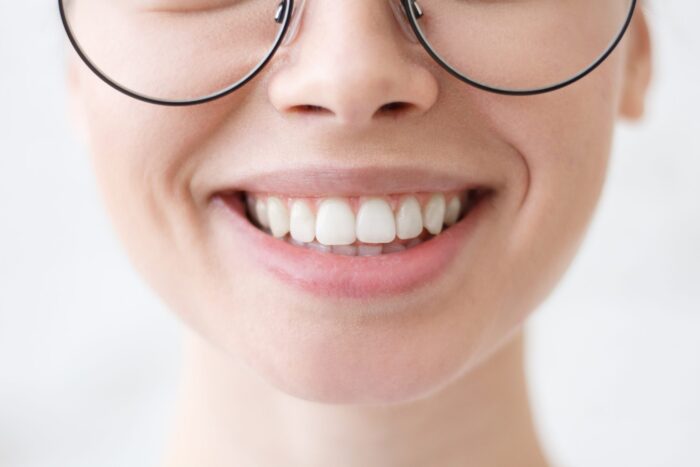 Treat White Spots on Teeth in Arlington Heights, IL
