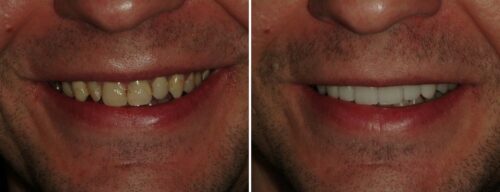 Results after dentistry at AH Smiles