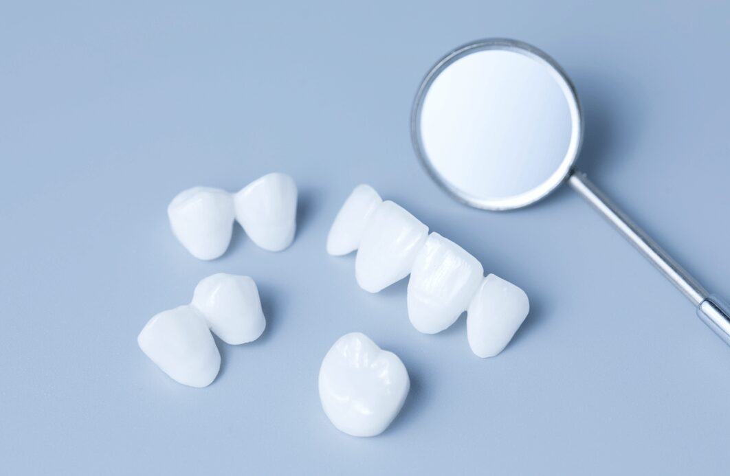 Porcelain Veneers in Arlington Heights, IL