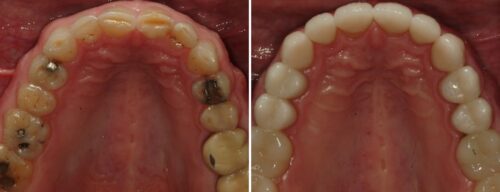 Results after dentistry at AH Smiles