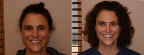 Results after dentistry at AH Smiles