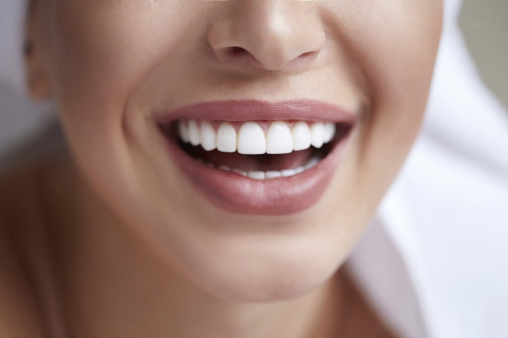 What To Know Before Veneer Treatment