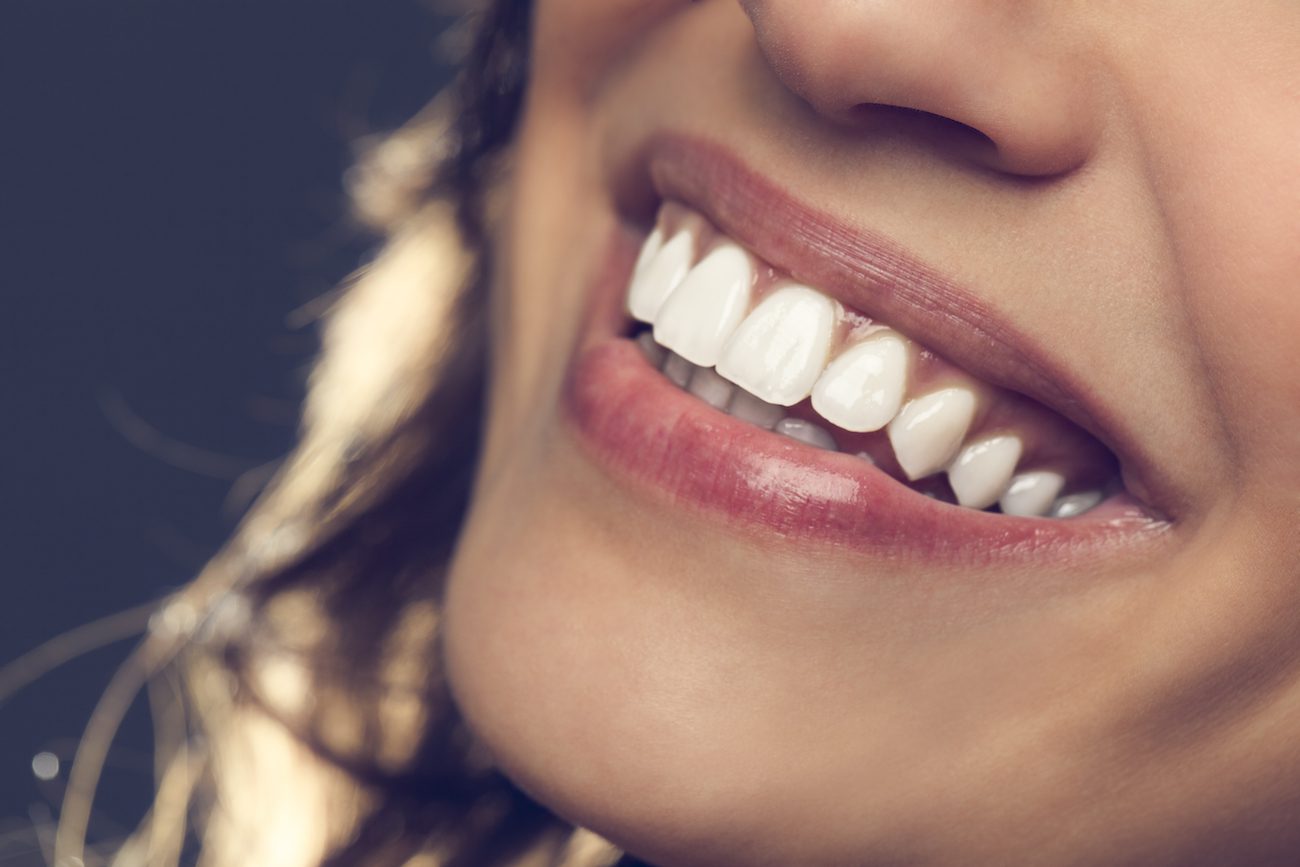 Does Insurance Cover Cosmetic Dentistry in Deerfield?