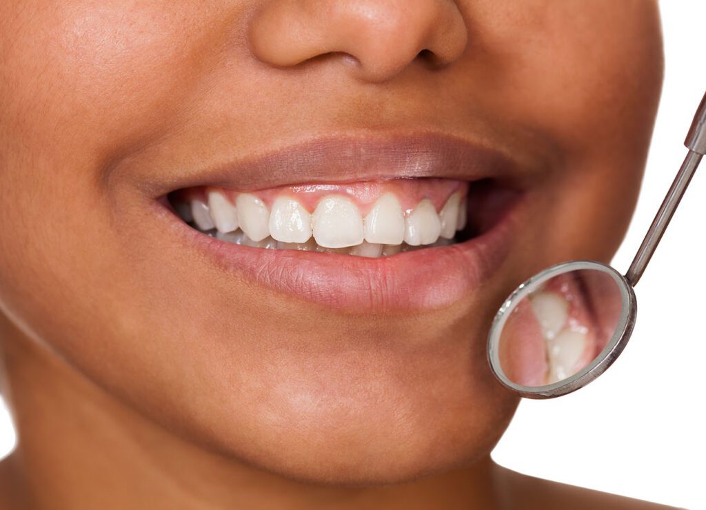 Bleeding Gums in Arlington Heights IL are often caused by gum disease