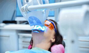 Why Choose Professional Teeth Whitening in Arlington Heights, IL