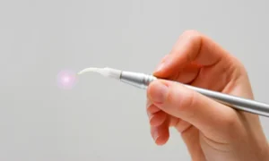 Laser Dentistry: A Gentler Way to Treat Gums in Arlington Heights, IL